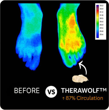 TheraWolf